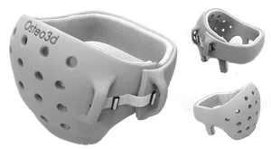 Custom cranial remodeling helmet