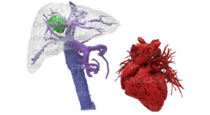 Custom 3D printed organ model